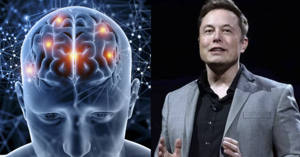 Chip não của Elon Musk gặp vấn đề sau 3 tháng cấy ghép vào bệnh nhân